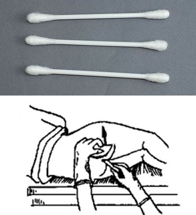 Stick di analisi