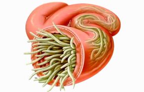Come pulire l'intestino dai parassiti
