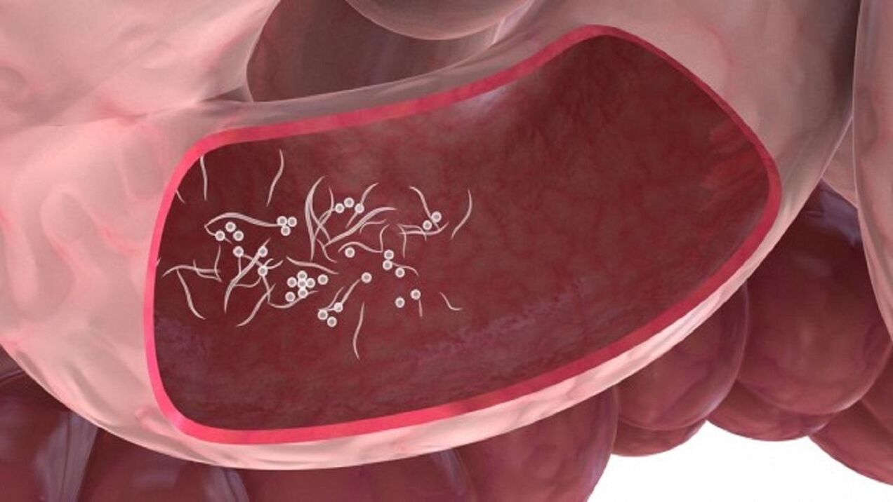 Parassiti Giardia nel fegato