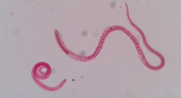 che aspetto hanno le trichine