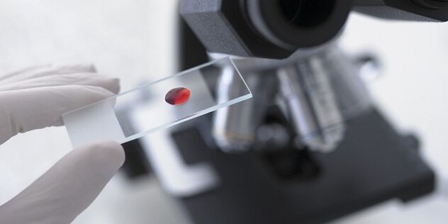 esame del sangue per diagnosticare i parassiti nel corpo